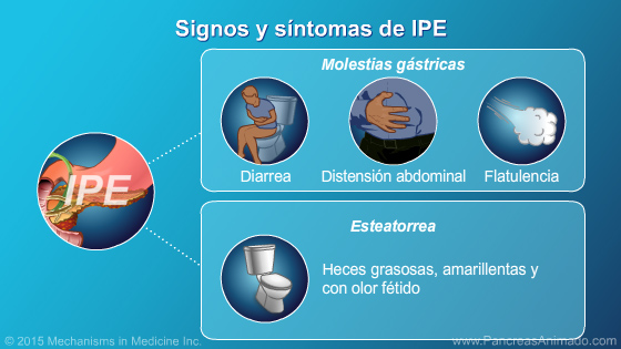 Insuficiencia pancreática exocrina (IPE) - Slide Show - 9