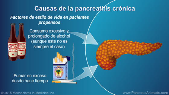 Manejo y tratamiento de la pancreatitis crónica - Slide Show - 5
