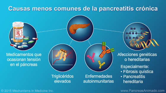Pancreatitis crónica - Slide Show - 6