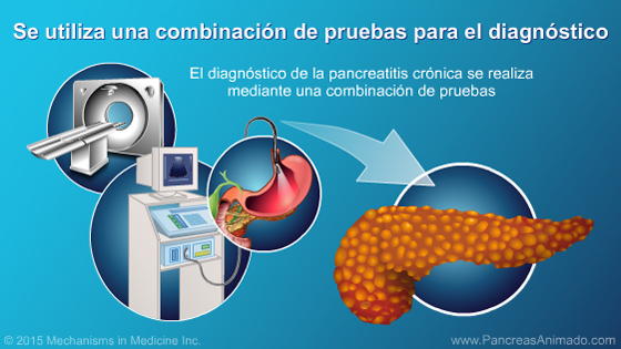 Pancreatitis crónica - Slide Show - 12