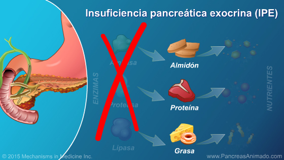 Insuficiencia pancreática exocrina (IPE) - Slide Show - 6