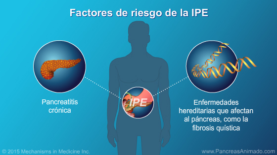 Insuficiencia pancreática exocrina (IPE) - Slide Show - 10