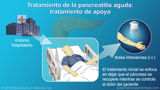 Manejo y tratamiento de la pancreatitis aguda - Slide Show - 6