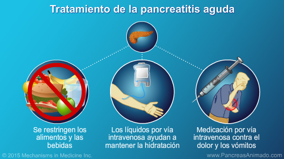 Manejo y tratamiento de la pancreatitis aguda - Slide Show - 7