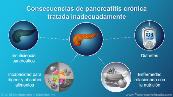 Manejo y tratamiento de la pancreatitis crónica - Slide Show - 6