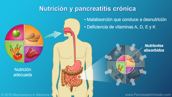 Manejo y tratamiento de la pancreatitis crónica - Slide Show - 9