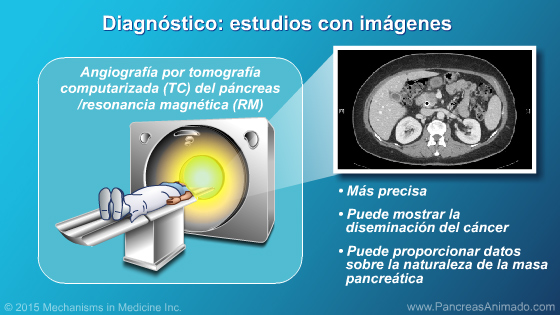 Fisiopatología, diagnóstico y estadificación - Slide Show - 10