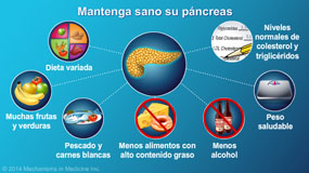 Manejo y tratamiento de la pancreatitis crónica - Presentación de diapositivas